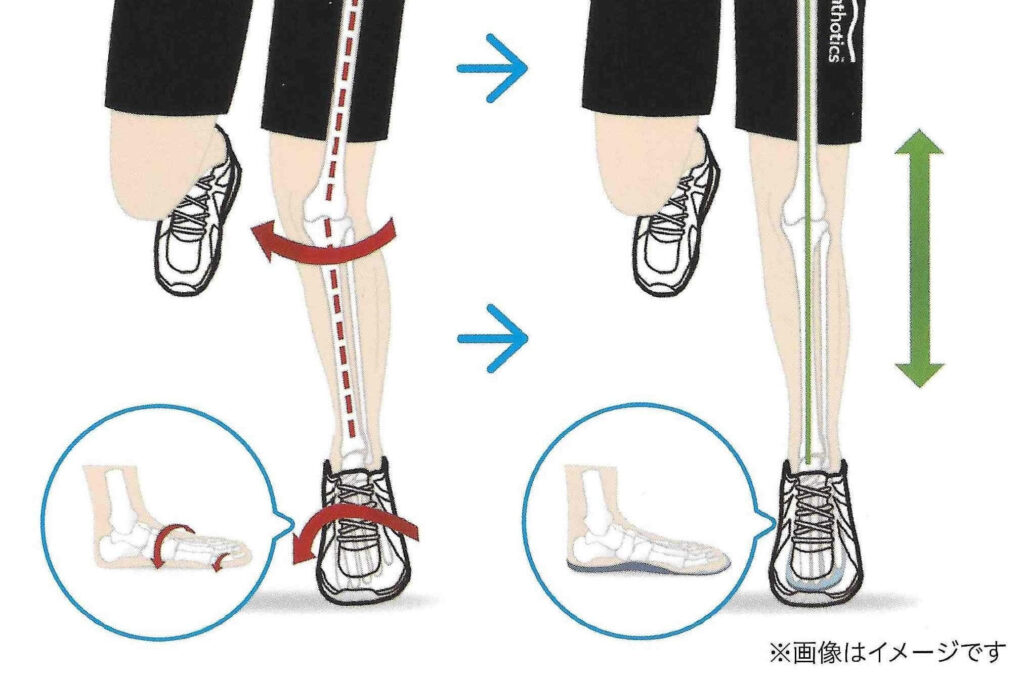 インソール(オーソティクス)ありとなしでの比較画像